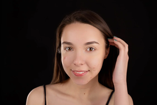 Adult breakouts causes