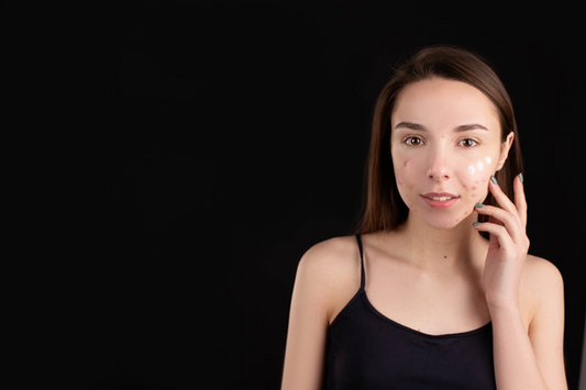 A teenager applying face cream